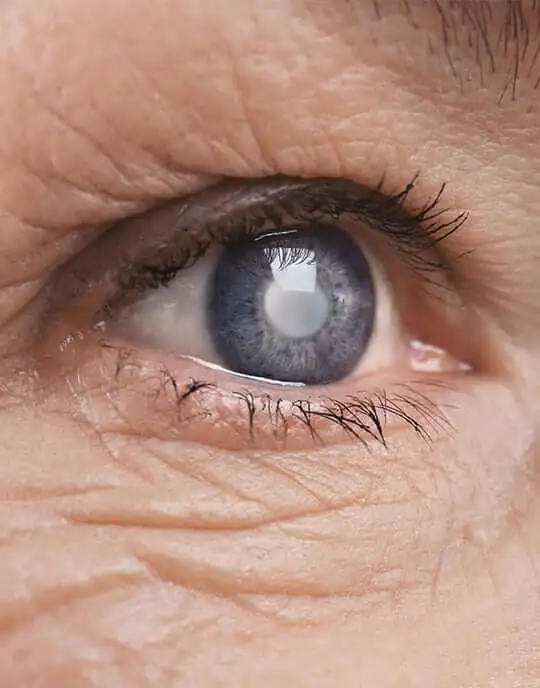 drsharjeel-supimg-glaucomaeyeexams